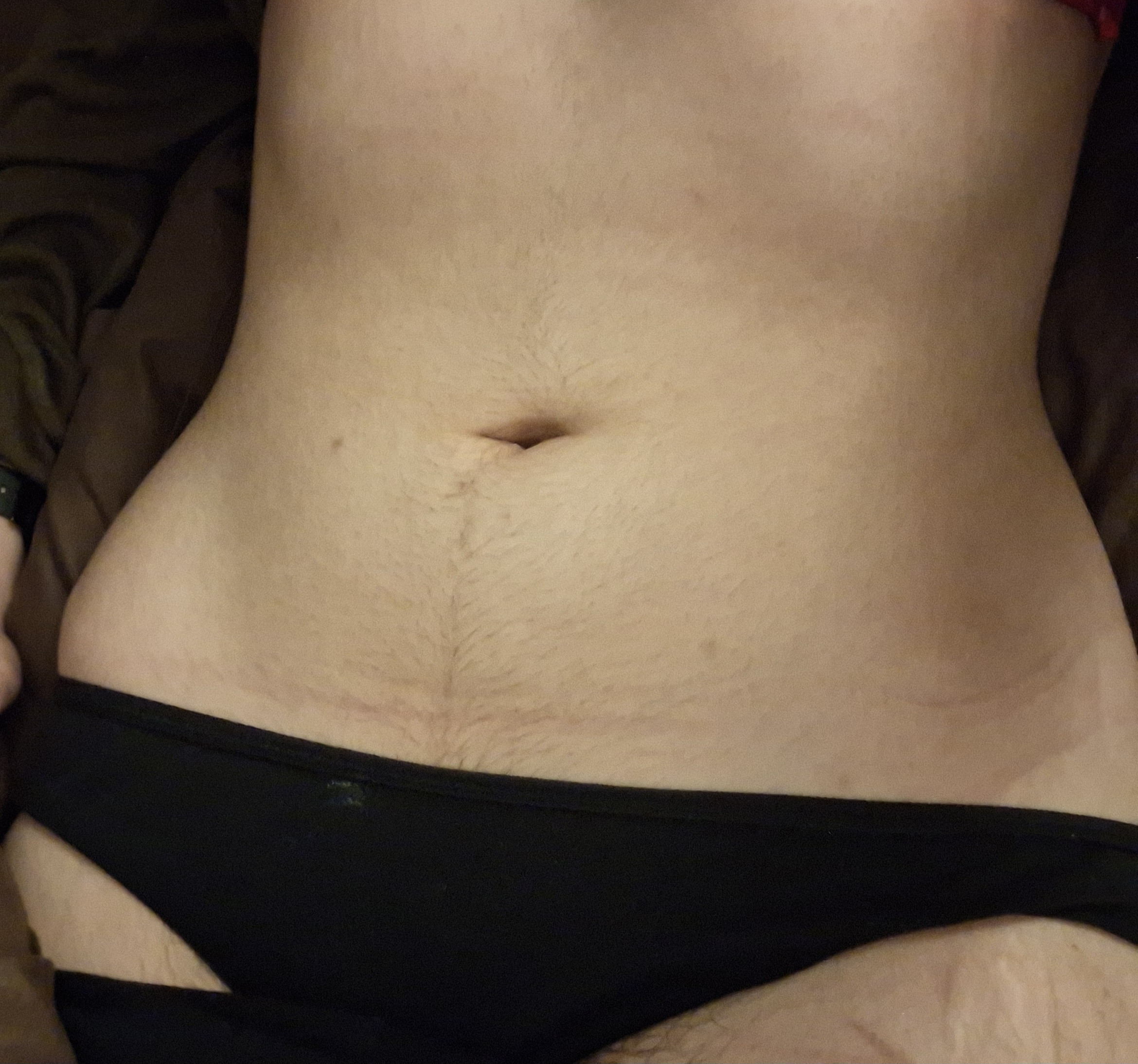 Gimme attention esfores >_<